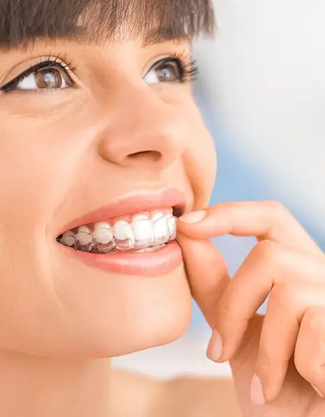Sonrisa con brackets estéticos